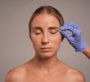 Blefaroplastia