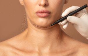 Lipopapada enzimática: tratamiento no invasivo para eliminar la papada